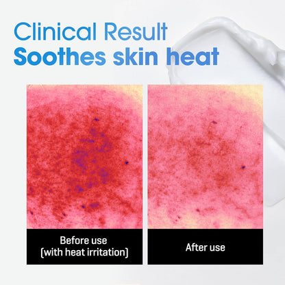 HealLuna Korean Body Acne Care Set – Body Cleanser & Body Cream